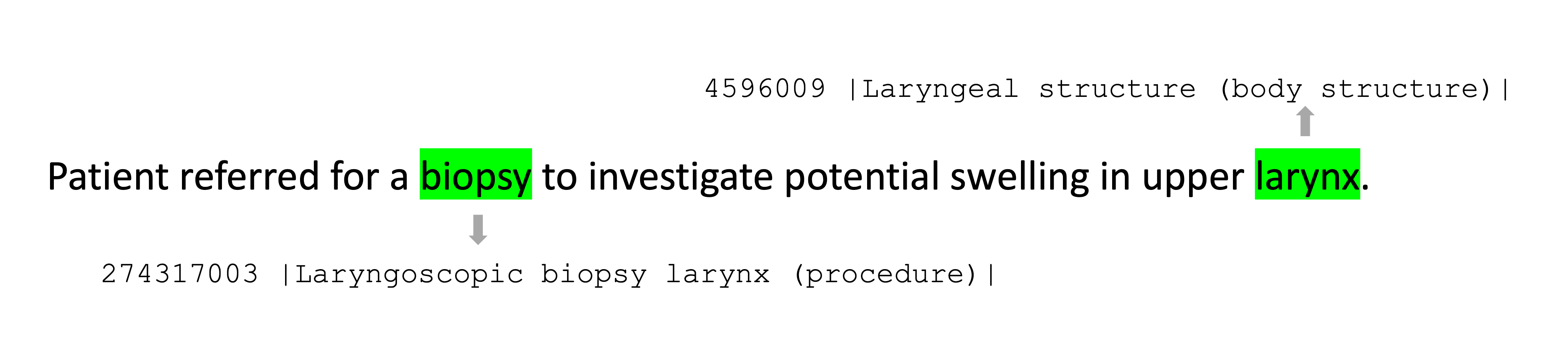 Synthetic example of annotating text with medical concepts from SNOMED CT.